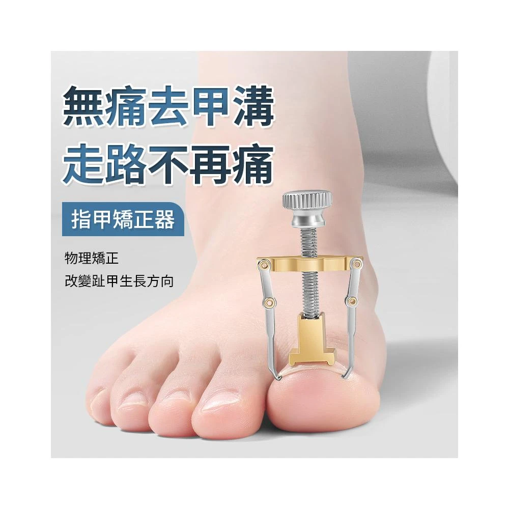 凍甲矯正器 矯正 指甲矯正器 矯正器 指甲內陷糾正器 嵌甲矯正器 QJ2308